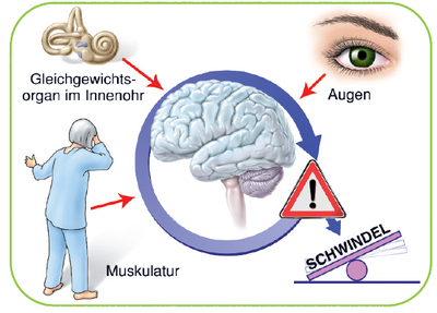 Abbildung: Gleichgewichtsstörung: So entsteht Schwindel